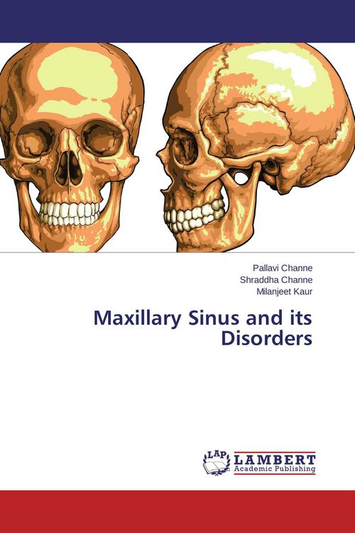 Produktbild: Maxillary Sinus and its Disorders