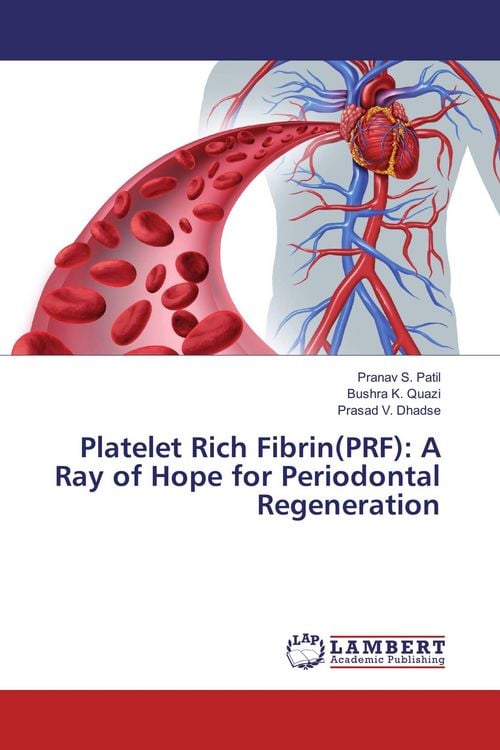 Produktbild: Platelet Rich Fibrin(PRF): A Ray of Hope for Periodontal Regeneration