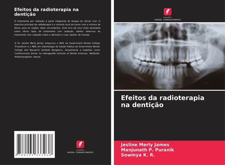Produktbild: Efeitos da radioterapia na denti&ccedil;&atilde;o