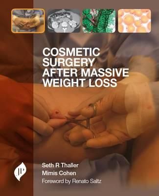 Produktbild: Thaller, S: Cosmetic Surgery after Massive Weight Loss
