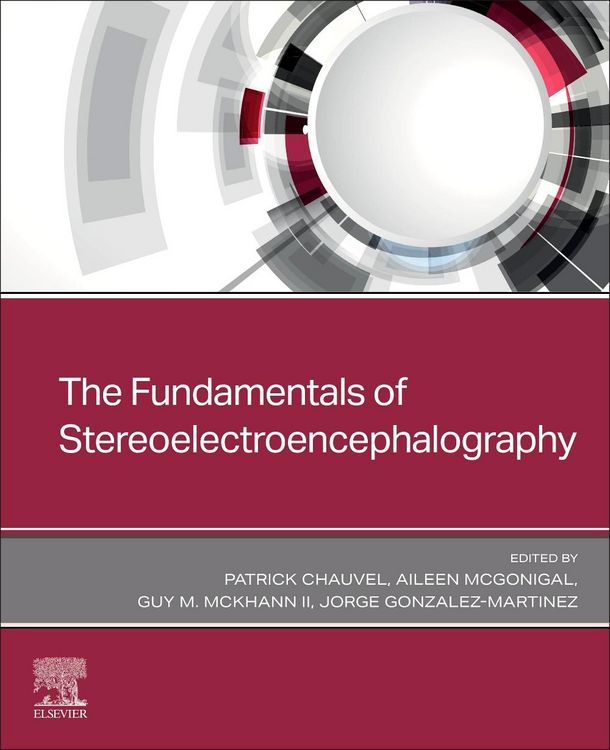 Produktbild: The Fundamentals of Stereoelectroencephalography