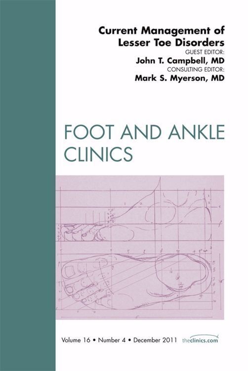 Produktbild: Current Management of Lesser Toe Disorders, an Issue of Foot and Ankle Clinics
