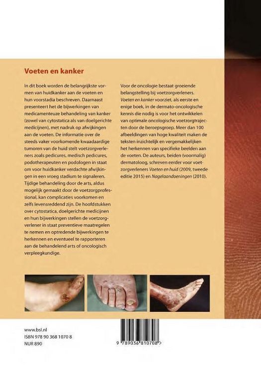 Produktbild: Voeten en kanker