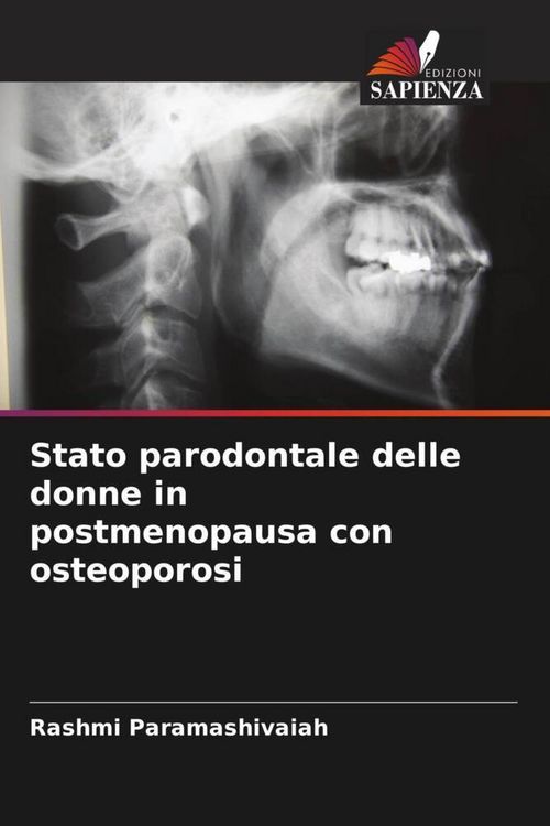 Produktbild: Stato parodontale delle donne in postmenopausa con osteoporosi