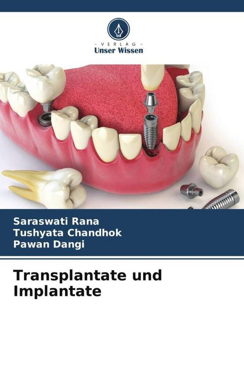 Produktbild: Transplantate und Implantate