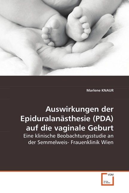 Produktbild: KNAUR, M: Auswirkungen der Epiduralan&auml;sthesie (PDA) auf diev