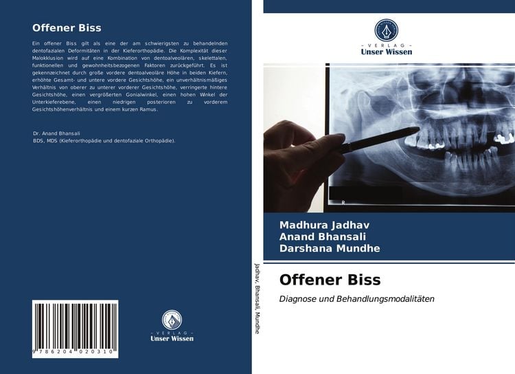 Produktbild: Offener Biss