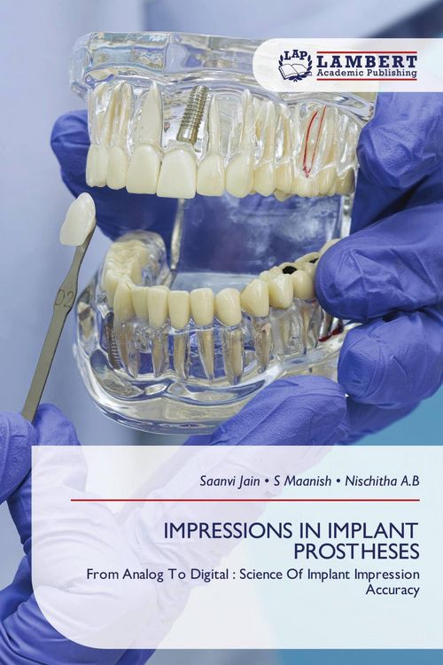 Produktbild: IMPRESSIONS IN IMPLANT PROSTHESES