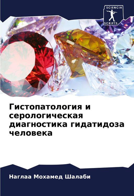 Produktbild: Gistopatologiq i serologicheskaq diagnostika gidatidoza cheloweka