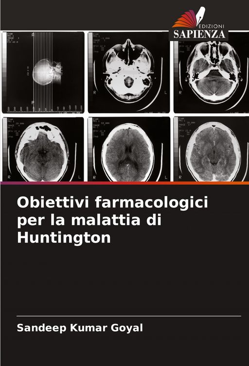 Produktbild: Obiettivi farmacologici per la malattia di Huntington
