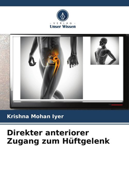 Produktbild: Direkter anteriorer Zugang zum H&uuml;ftgelenk