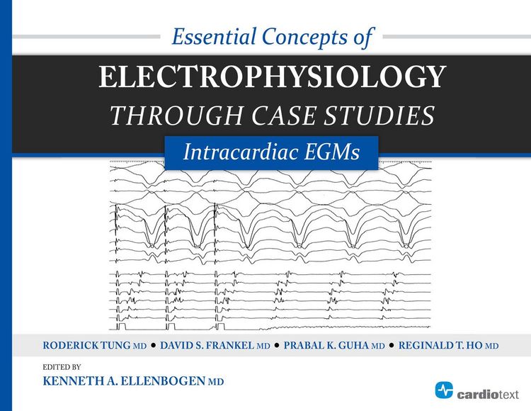 Produktbild: Essential Concepts of Electrophysiology through Case Studies: Intracardiac EGMs