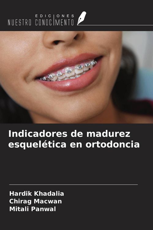 Produktbild: Indicadores de madurez esquel&eacute;tica en ortodoncia