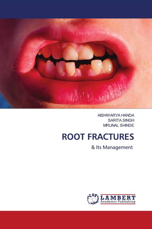 Produktbild: Root Fractures