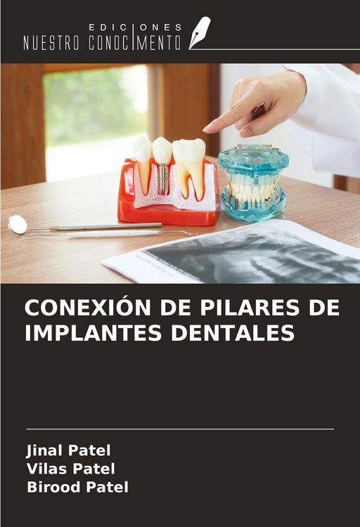 Produktbild: Conexi&oacute;n De Pilares De Implantes Dentales
