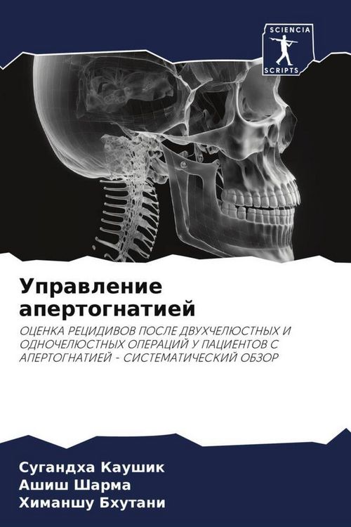 Produktbild: Uprawlenie apertognatiej