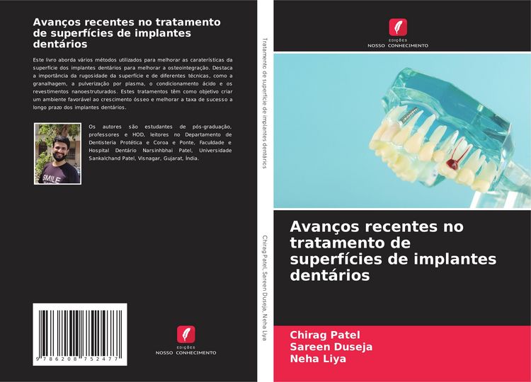 Produktbild: Avan&ccedil;os recentes no tratamento de superf&iacute;cies de implantes dent&aacute;rios