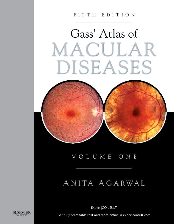 Produktbild: Agarwal, A: Gass' Atlas of Macular Diseases
