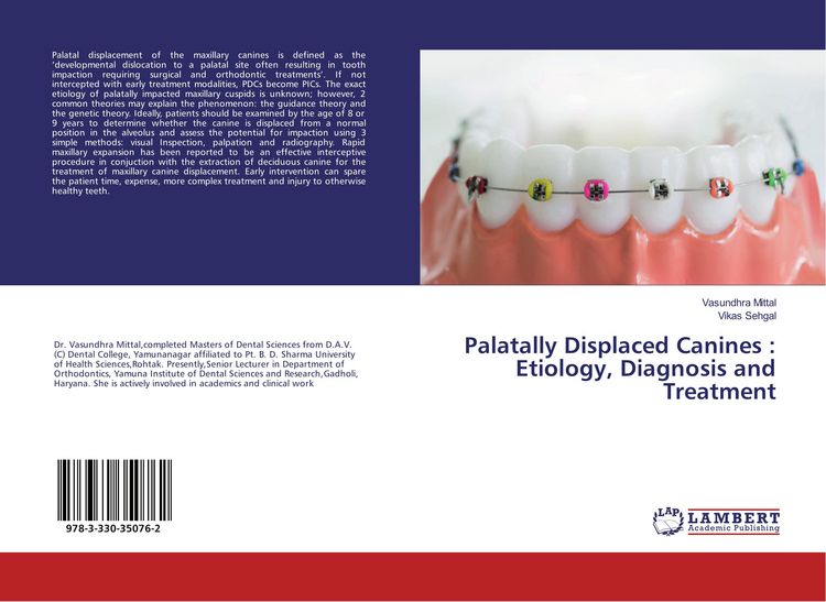 Produktbild: Palatally Displaced Canines : Etiology, Diagnosis and Treatment