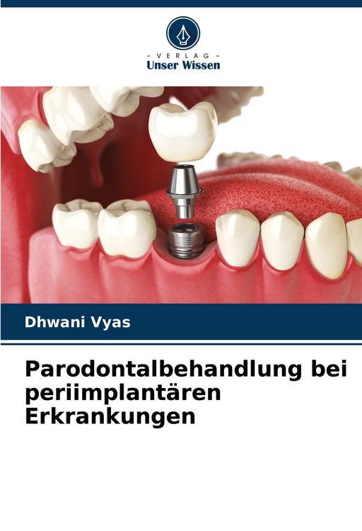 Produktbild: Parodontalbehandlung bei periimplant&auml;ren Erkrankungen