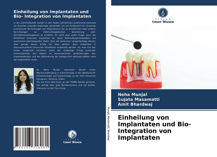 Produktbild: Einheilung von Implantaten und Bio- Integration von Implantaten