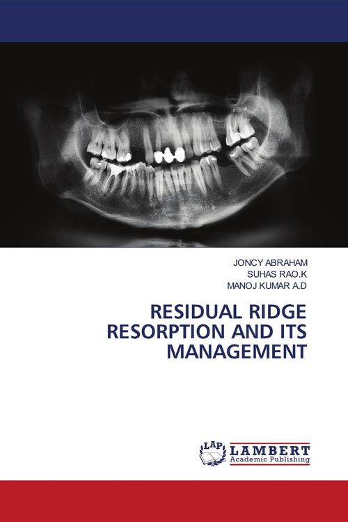 Produktbild: Residual Ridge Resorption and Its Management