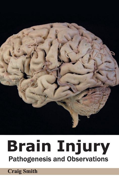 Produktbild: Brain Injury