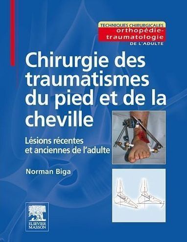 Produktbild: Chirurgie des Traumatismes du Pied et de la Cheville; Lesions