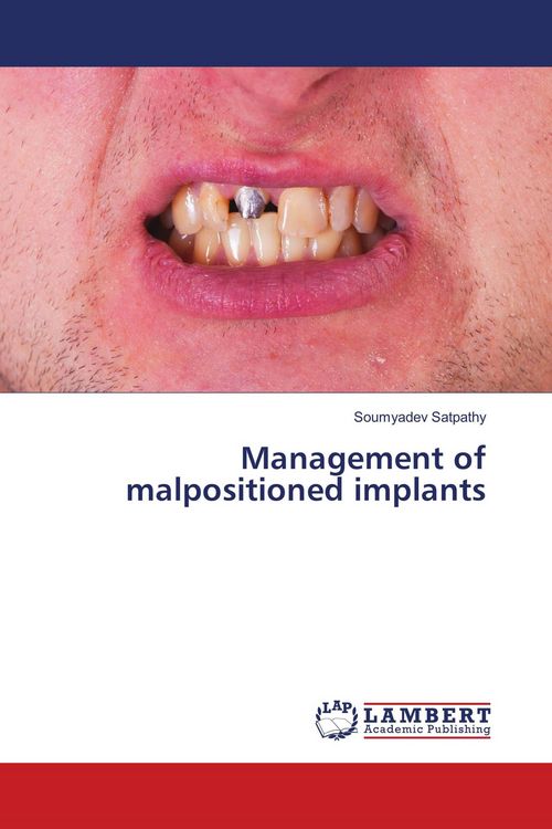 Produktbild: Management of malpositioned implants