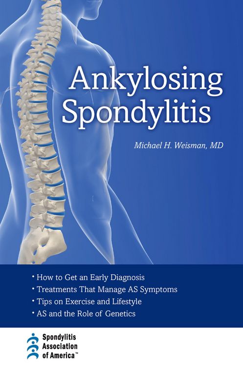 Produktbild: Ankylosing Spondylitis