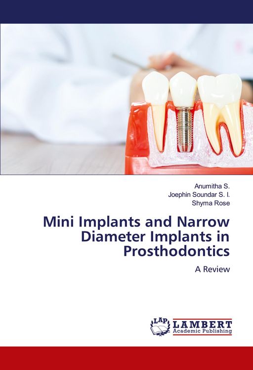 Produktbild: Mini Implants and Narrow Diameter Implants in Prosthodontics