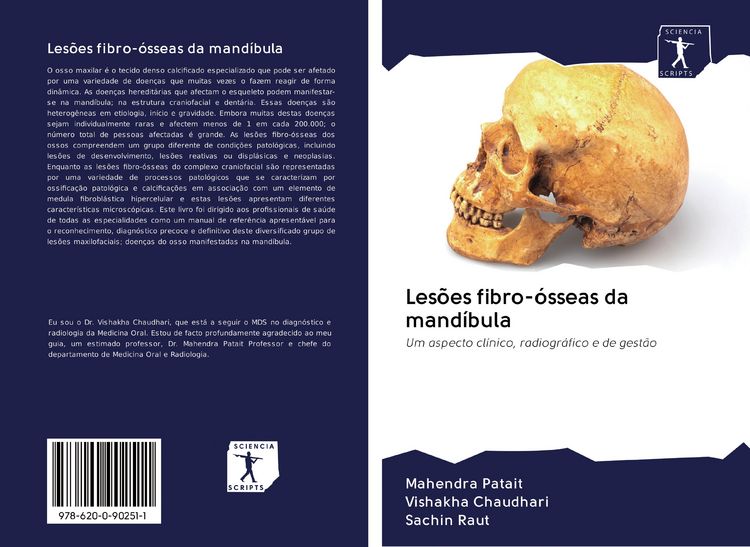 Produktbild: Les&otilde;es fibro-&oacute;sseas da mand&iacute;bula