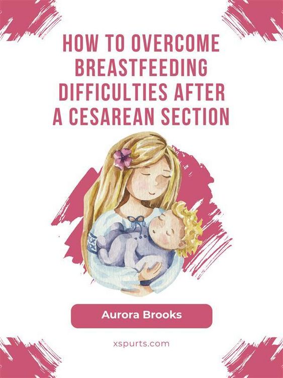 Produktbild: How to overcome breastfeeding difficulties after a cesarean section