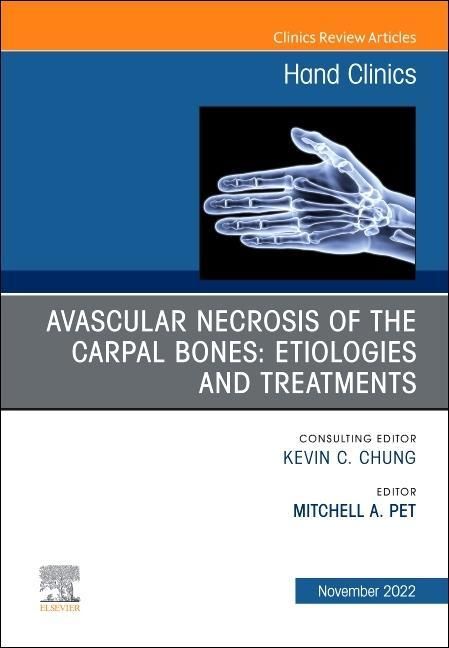 Produktbild: Avascular Necrosis of the Carpal Bones: Etiologies and Treatments, an Issue of Hand Clinics