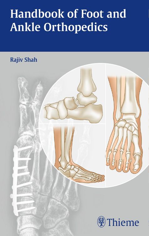 Produktbild: Handbook of Foot and Ankle Orthopedics