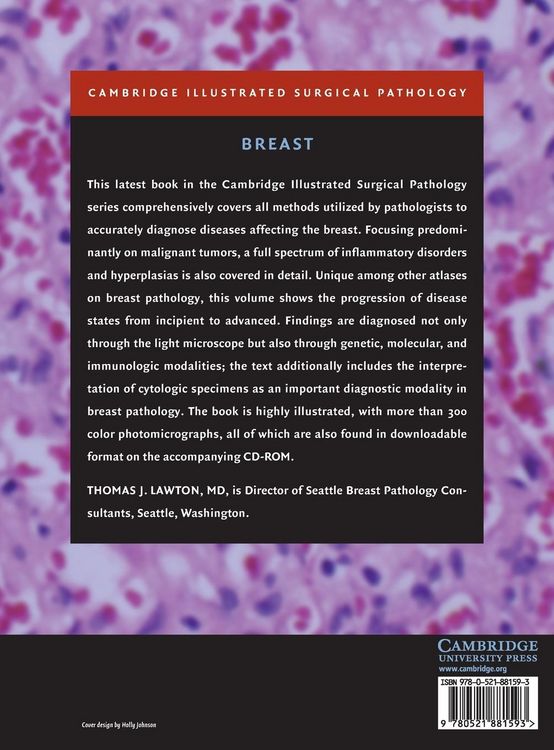 Produktbild: Illustrated Surgical Pathology of the Breast