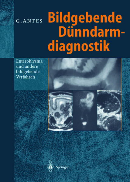 Produktbild: Bildgebende D&uuml;nndarmdiagnostik