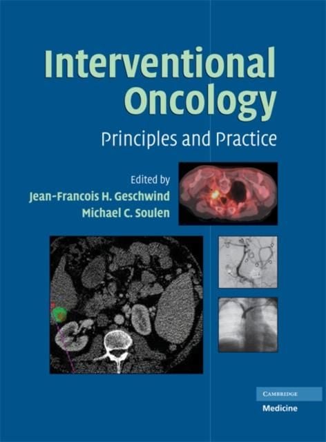 Produktbild: Interventional Oncology