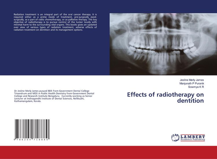 Produktbild: Effects of radiotherapy on dentition