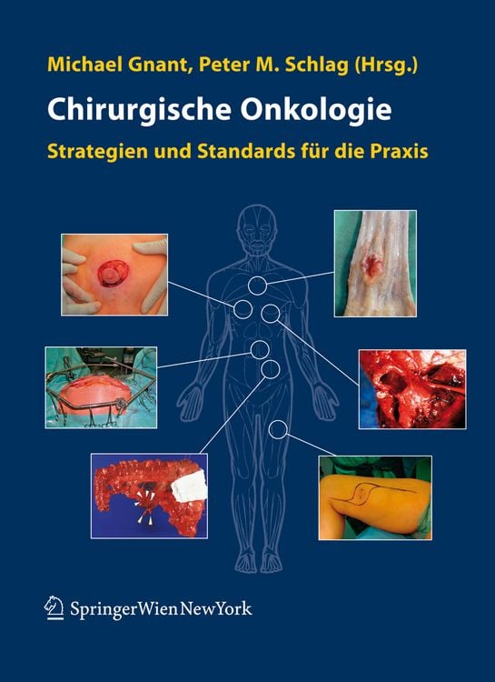 Produktbild: Chirurgische Onkologie