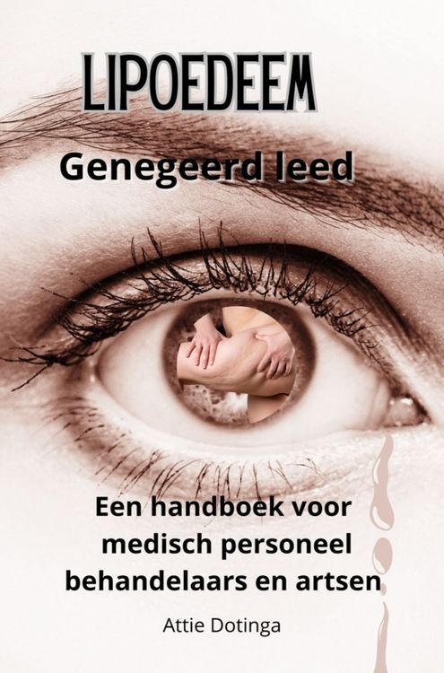 Produktbild: Lipoedeem