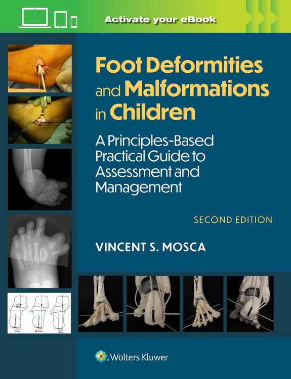 Produktbild: Foot Deformities and Malformations in Children