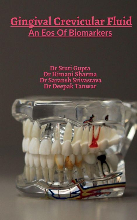 Produktbild: Gingival Crevicular Fluid