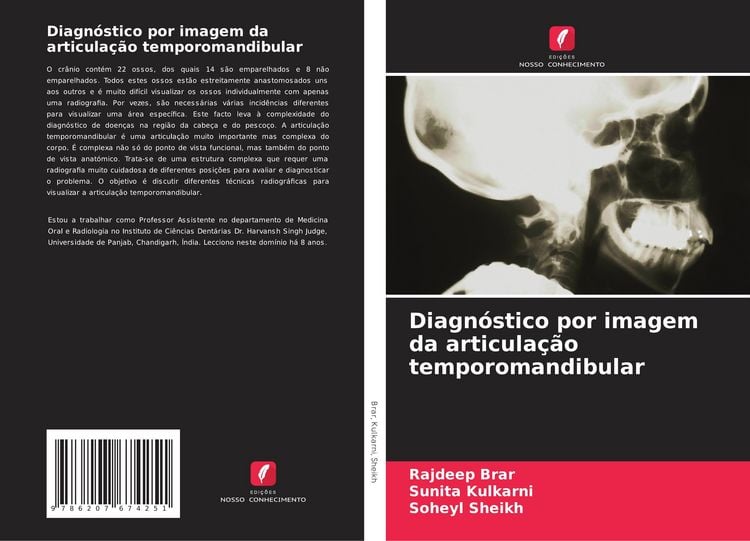 Produktbild: Diagn&oacute;stico por imagem da articula&ccedil;&atilde;o temporomandibular