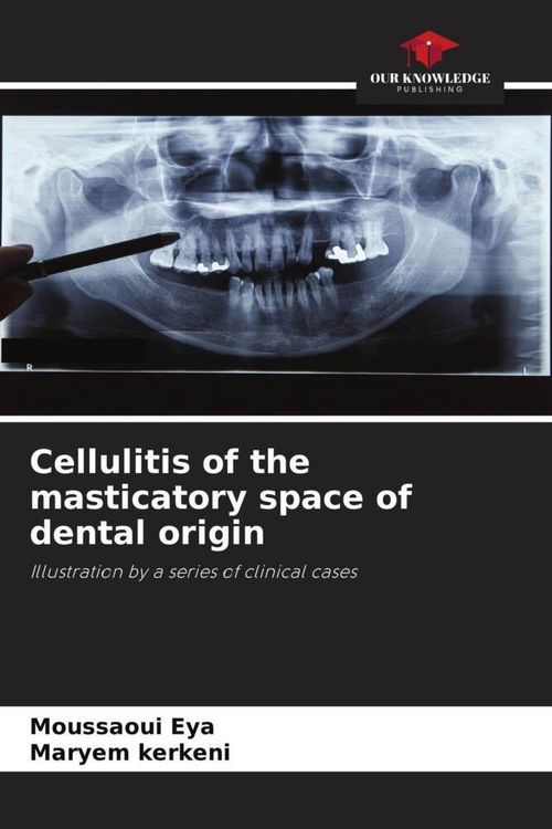 Produktbild: Cellulitis of the masticatory space of dental origin