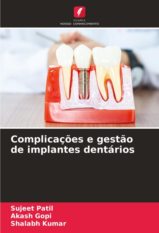 Produktbild: Complica&ccedil;&otilde;es e gest&atilde;o de implantes dent&aacute;rios