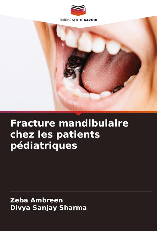 Produktbild: Fracture mandibulaire chez les patients p&eacute;diatriques