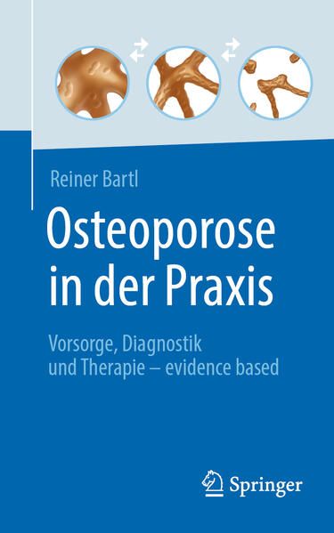 Produktbild: Osteoporose in der Praxis