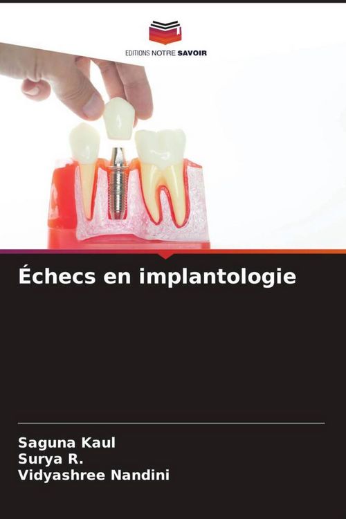Produktbild: &Eacute;checs en implantologie