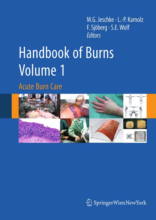Produktbild: Handbook of Burns Volume 1